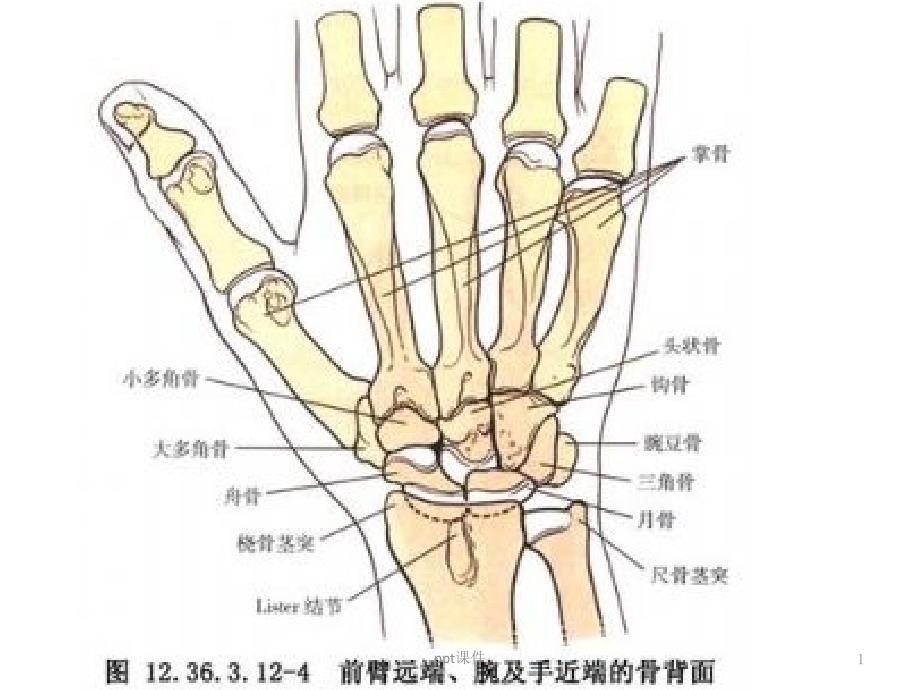 尺桡骨干骨折克氏针内固定术-课件_第1页