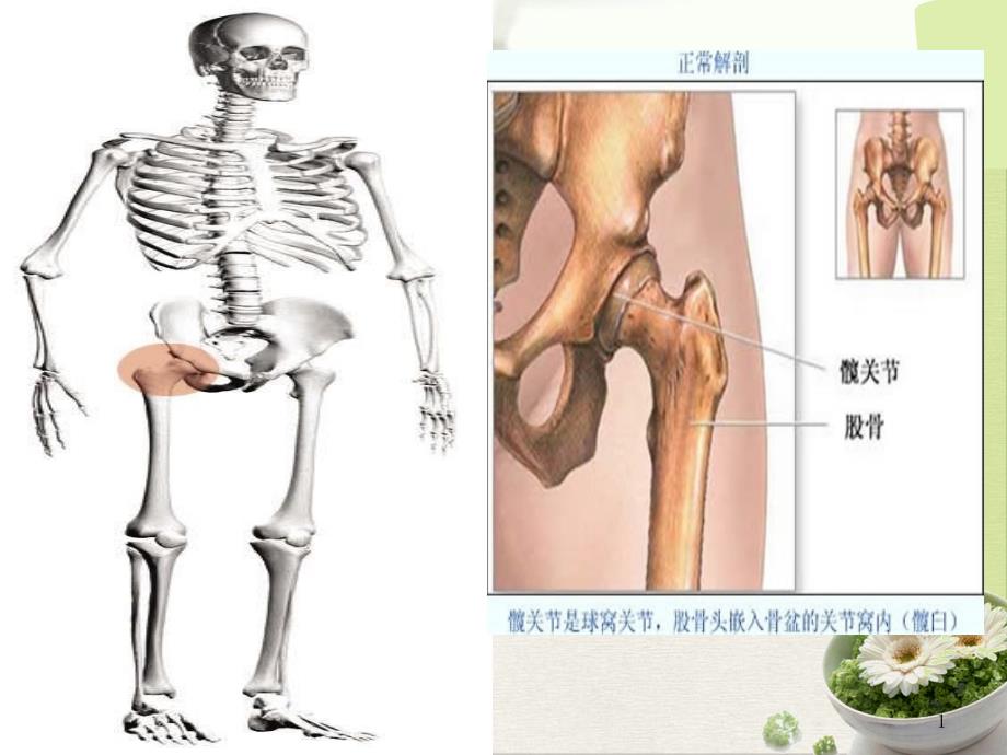 髋关节置换术后康复护理ppt课件完整版_第1页