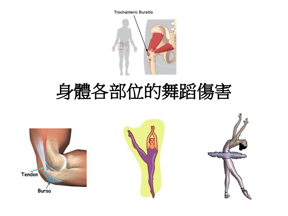 髋关节外伤症状课件_第1页