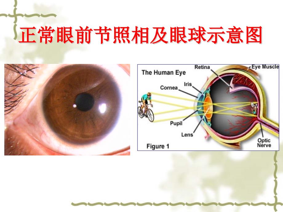 基质层角膜基质的超微构造基质细胞厚度课件_第1页