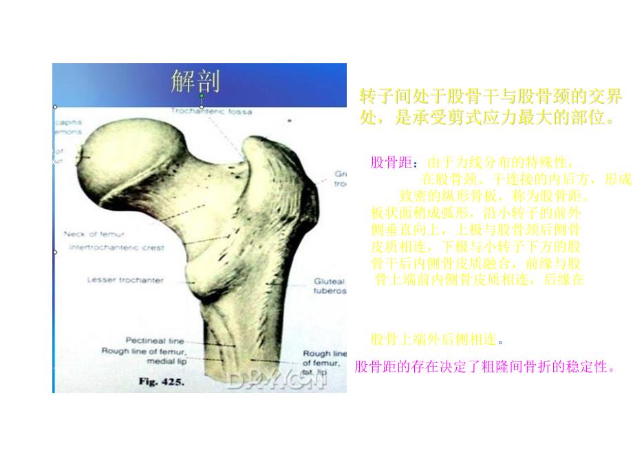 人工关节置换术课件_第1页