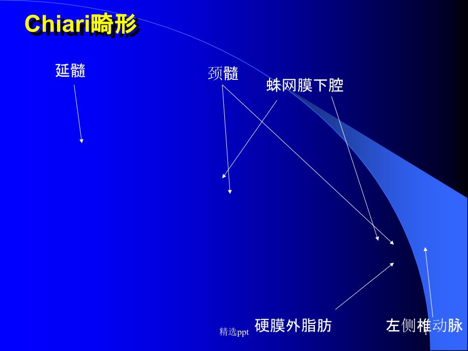 《头部CT诊断》课件_第1页