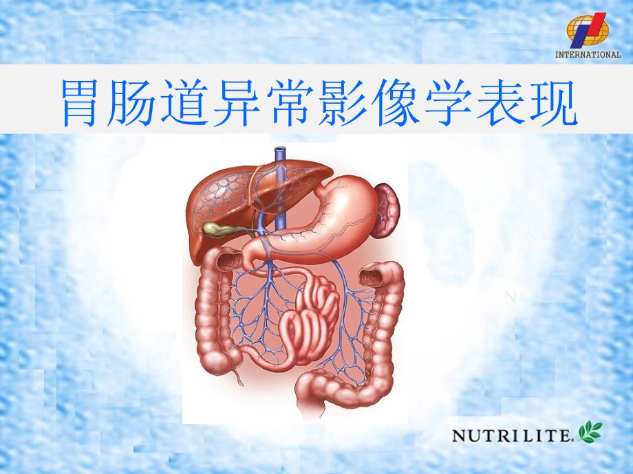 影像诊断学教学-消化道基本病变课件_第1页