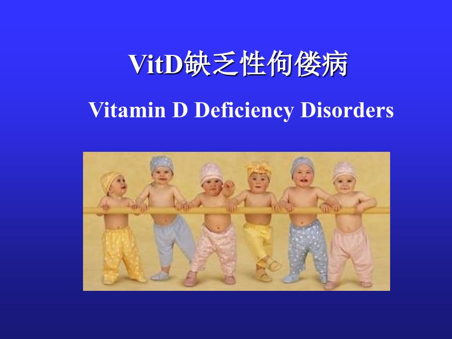 vitd缺乏性佝偻病课件_第1页