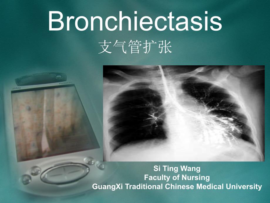 内科护理学课件 英语 考试资料Bronchiectasis_第1页