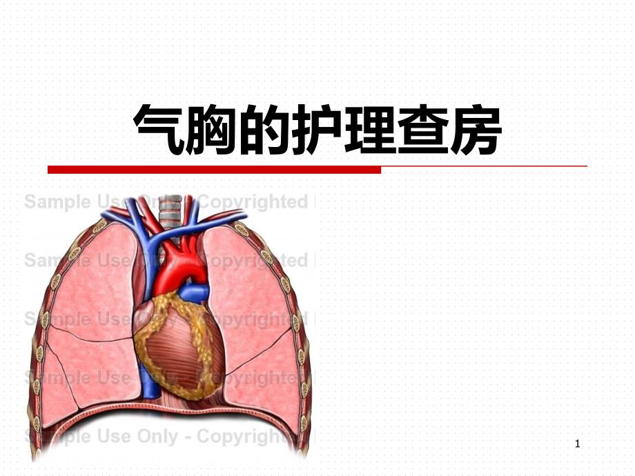 气胸的护理查房课件_第1页