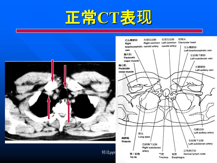 肺部正常CT课件_第1页