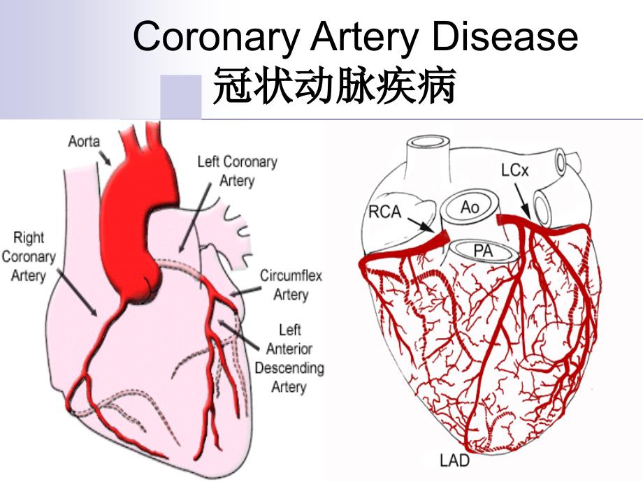 内科护理学课件 英语 考试资料CoronaryArteryDisease_第1页