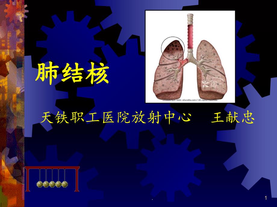 肺结核分型课件_第1页