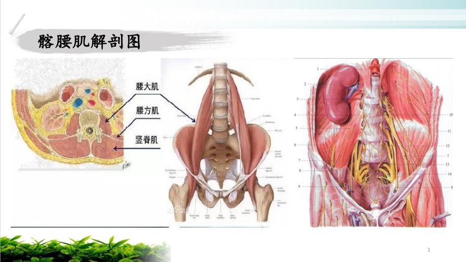 髂腰肌源性腰腿痛治疗课件_第1页