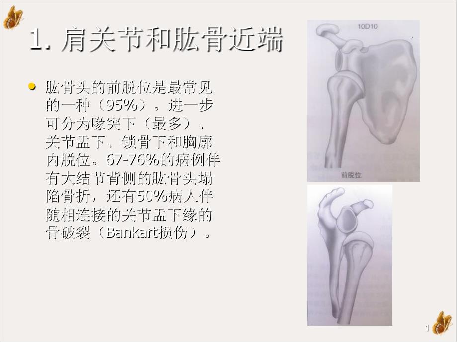 骨折与脱位诊断分型及治疗二实用ppt课件_第1页