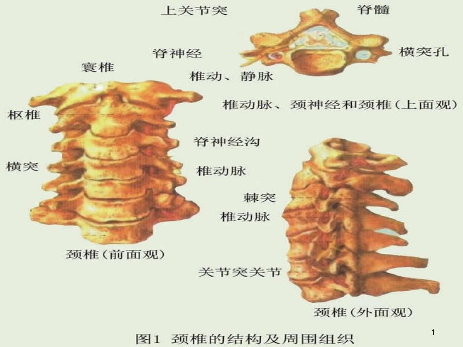 颈椎X线诊断判断椎体退变课件_第1页