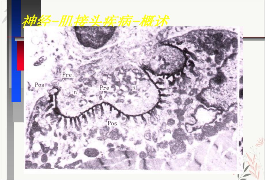 神经病学教学重症肌无力中文 ppt课件_第1页