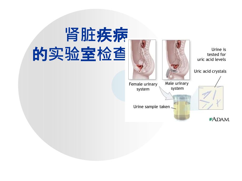 肾脏疾病实验室检查课件_第1页