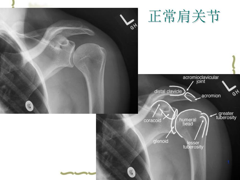 骨科常见疾病医疗管理知识分析课件_第1页