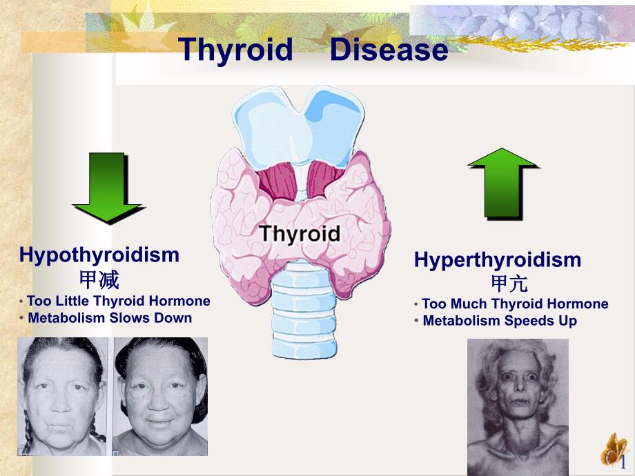 甲状腺激素实用ppt课件_第1页