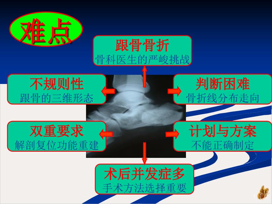 跟骨骨折治疗的理念ppt教材课件_第1页