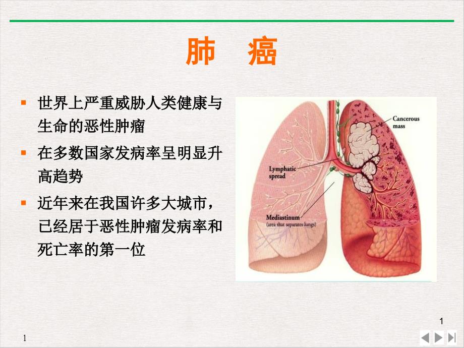 非小细胞肺癌的常用化疗方案PPT实用版课件_第1页