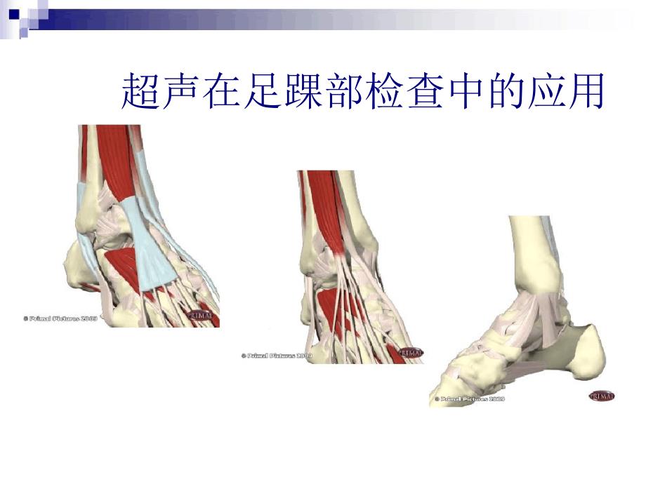 超声在足踝部检查中的应用课件_第1页