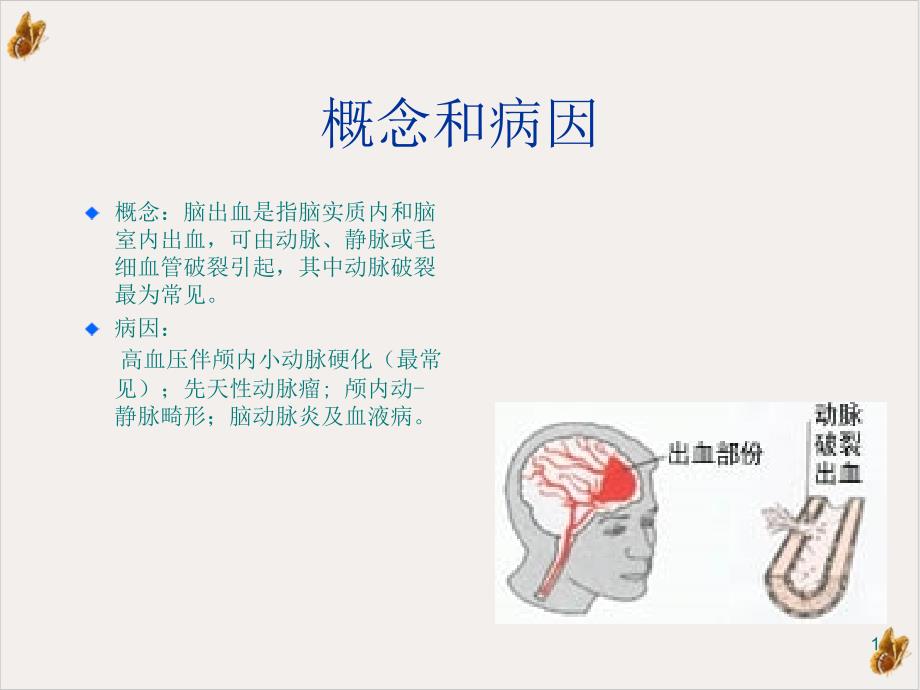 脑出血教学查房 课件_第1页