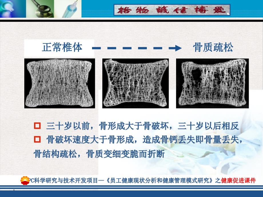 骨质疏松的健康管理ppt课件_第1页