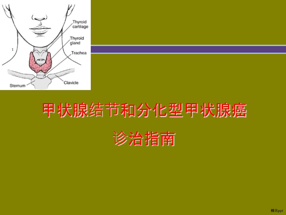 甲状腺结节指南课件_第1页