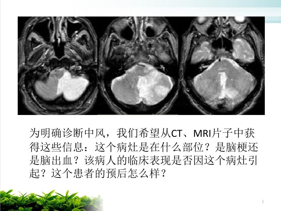 颅脑解剖课件_第1页