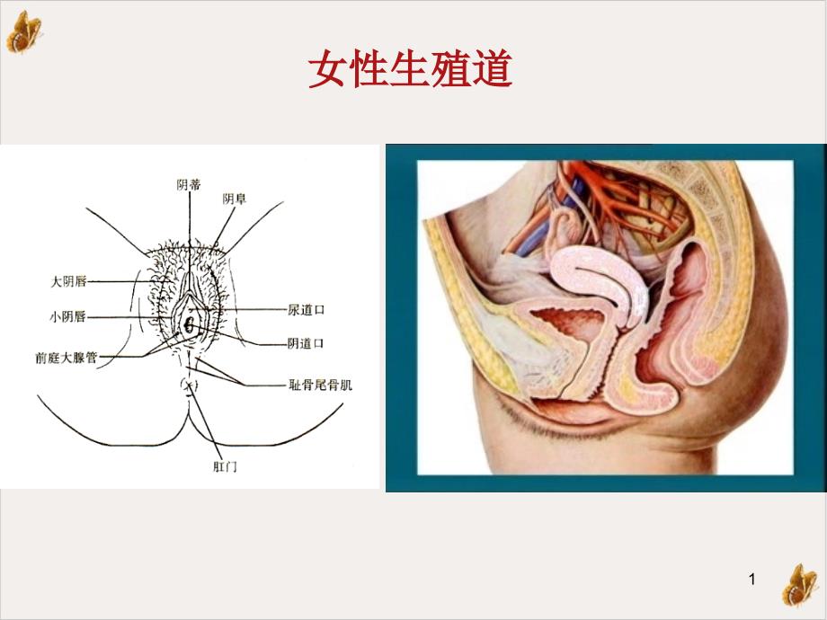 盆腔炎讲解课件_第1页