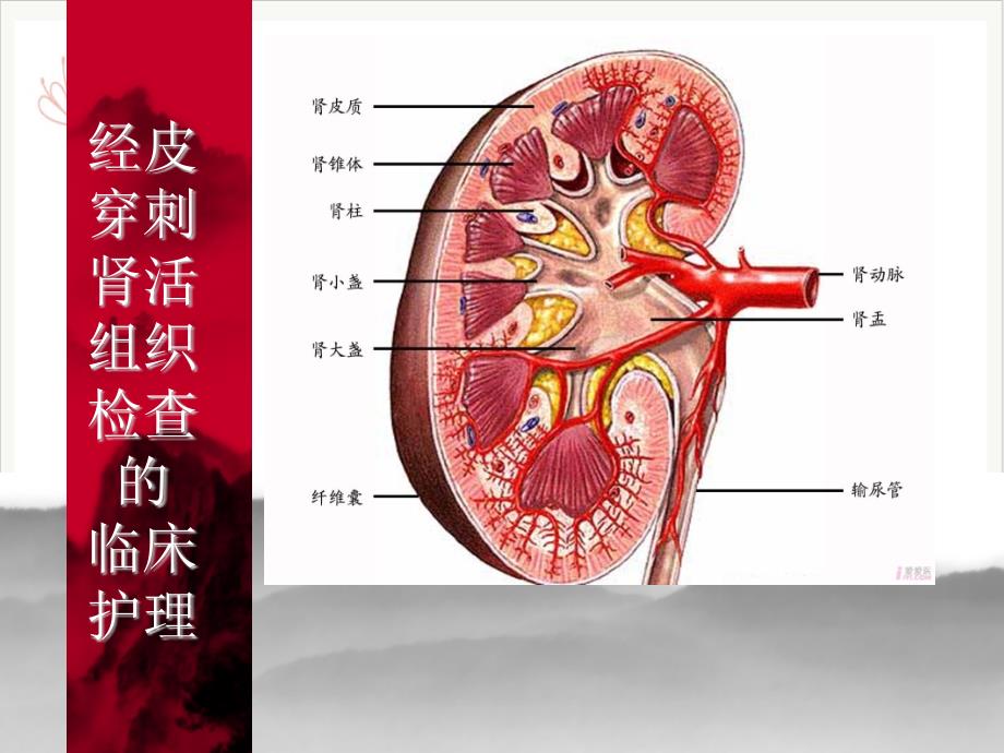 经皮穿刺肾活组织检查的课件_第1页