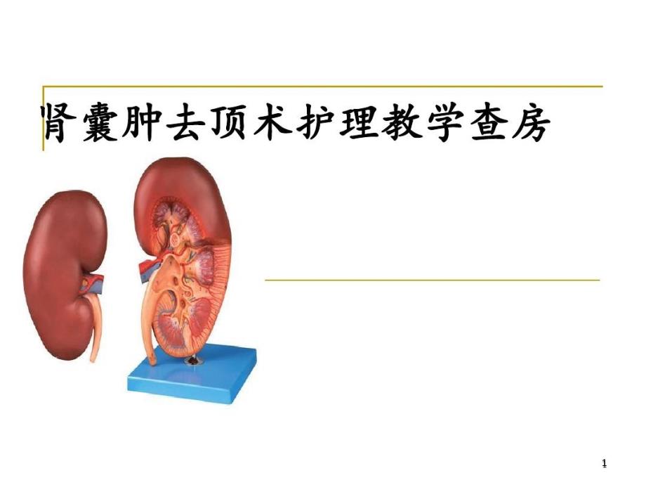 肾囊肿去顶术护理课件_第1页