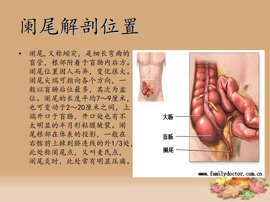 阑尾切除术的手术配合 ppt课件_第1页