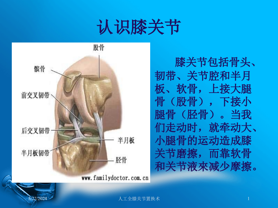 人工全膝关节置换术课件1_第1页