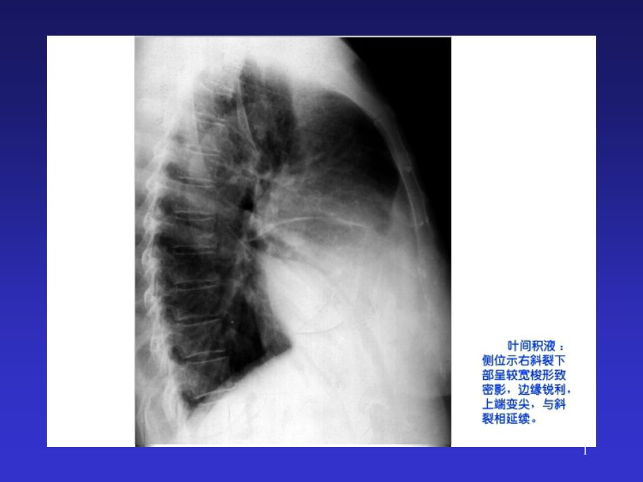 呼吸系统及纵隔多媒体教材课件_第1页