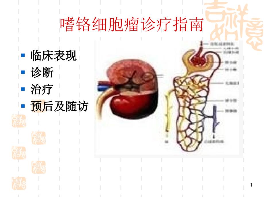 嗜铬细胞瘤诊疗指南课件_第1页