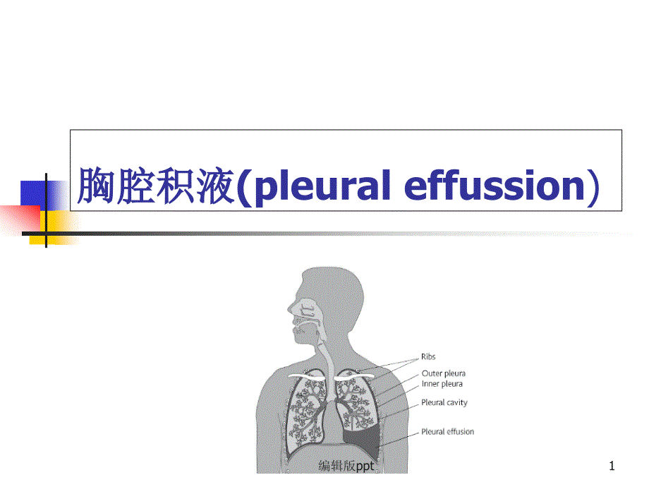 胸水教学讲解课件_第1页