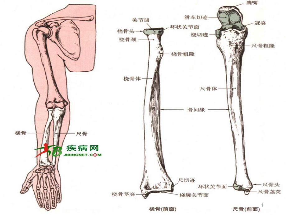 尺桡骨骨折的护理课件_第1页