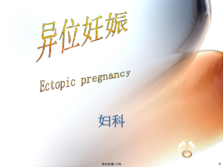 异位妊娠-妇科-课件_第1页
