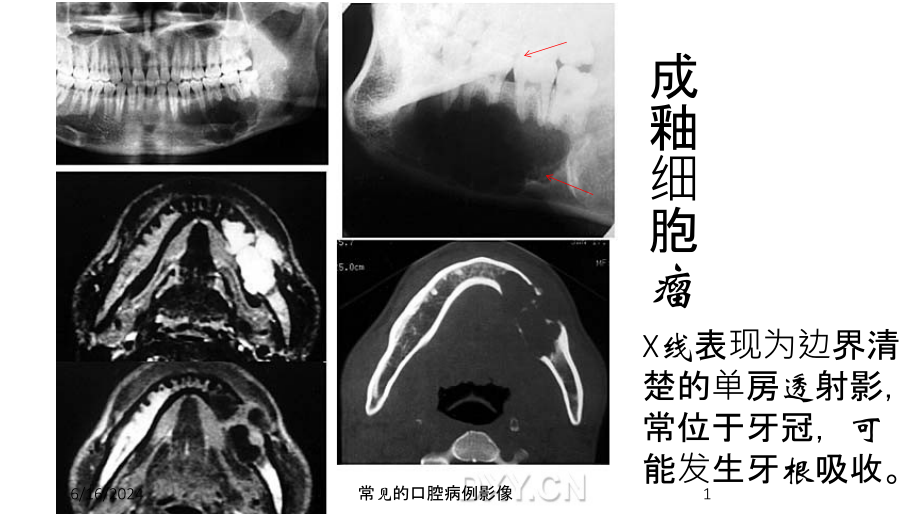 常见的口腔病例影像培训课件_第1页