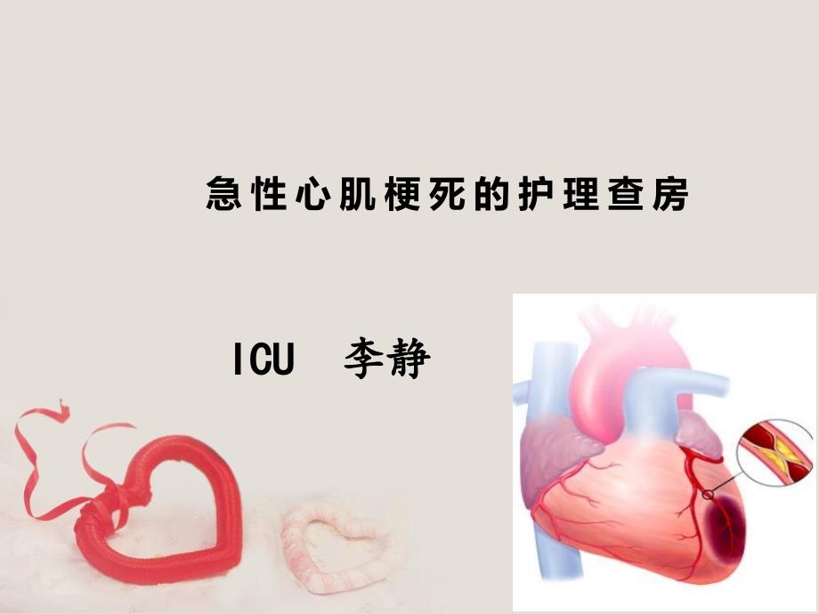 急性心肌梗死病人的护理查房课件_第1页