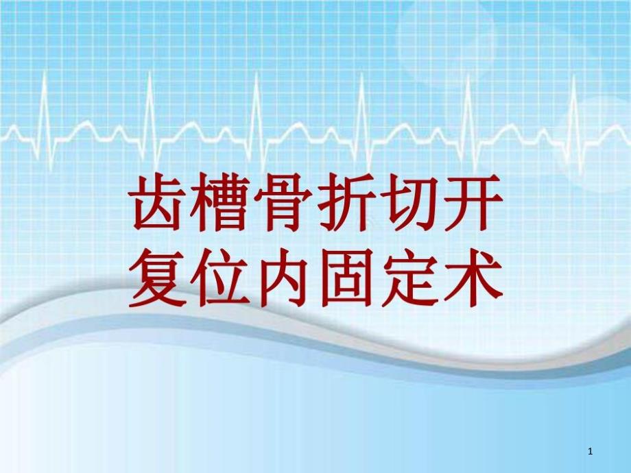 手术讲解模板齿槽骨折切开复位内固定术课件_第1页