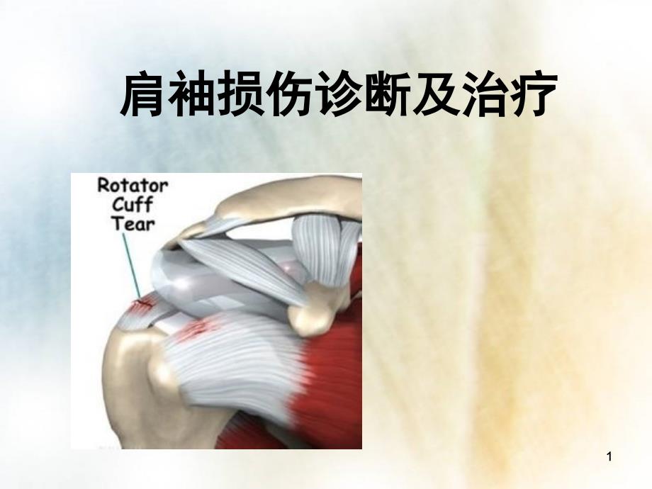 肩袖损伤的诊断及治疗课件_第1页