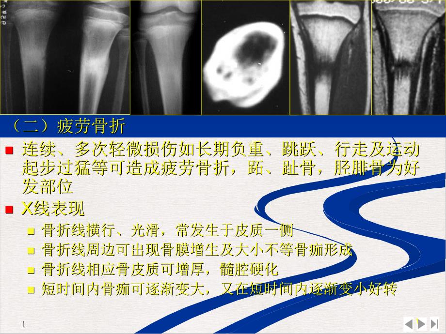 骨与关节创伤课件_第1页