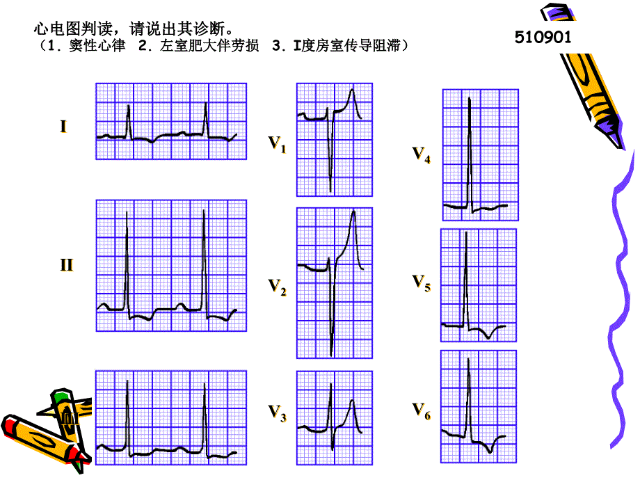 心电图试题及答案课件_第1页