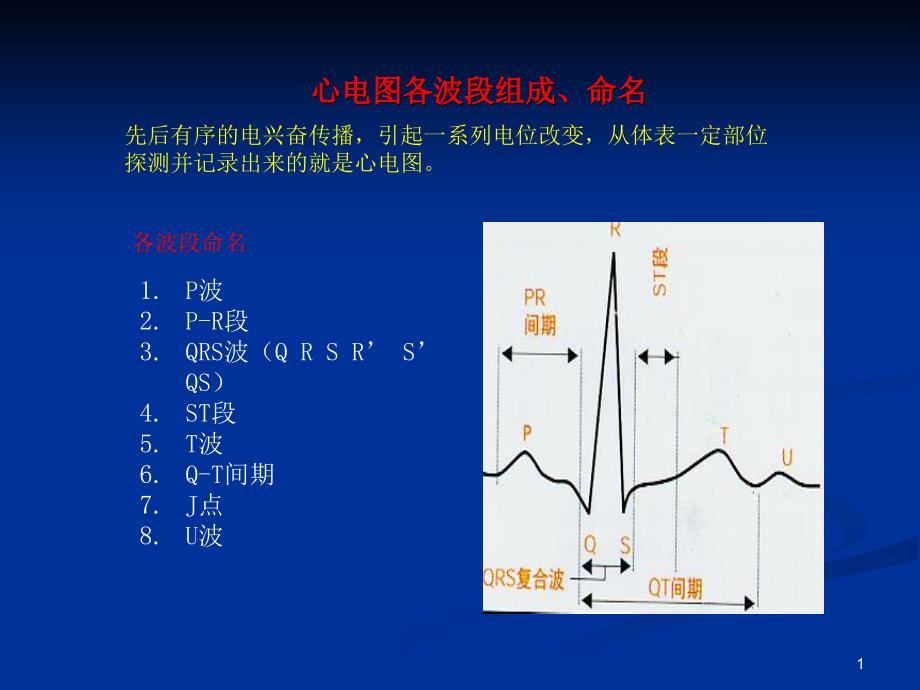 各种心电图表现ppt课件_第1页