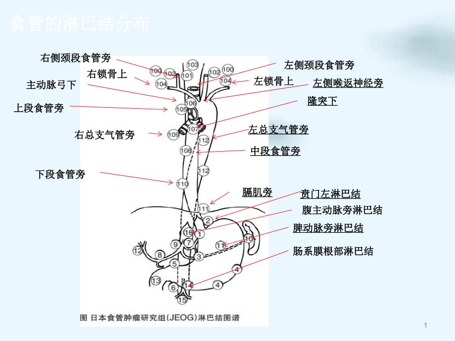 食管癌淋巴结三野清扫讲课ppt课件_第1页