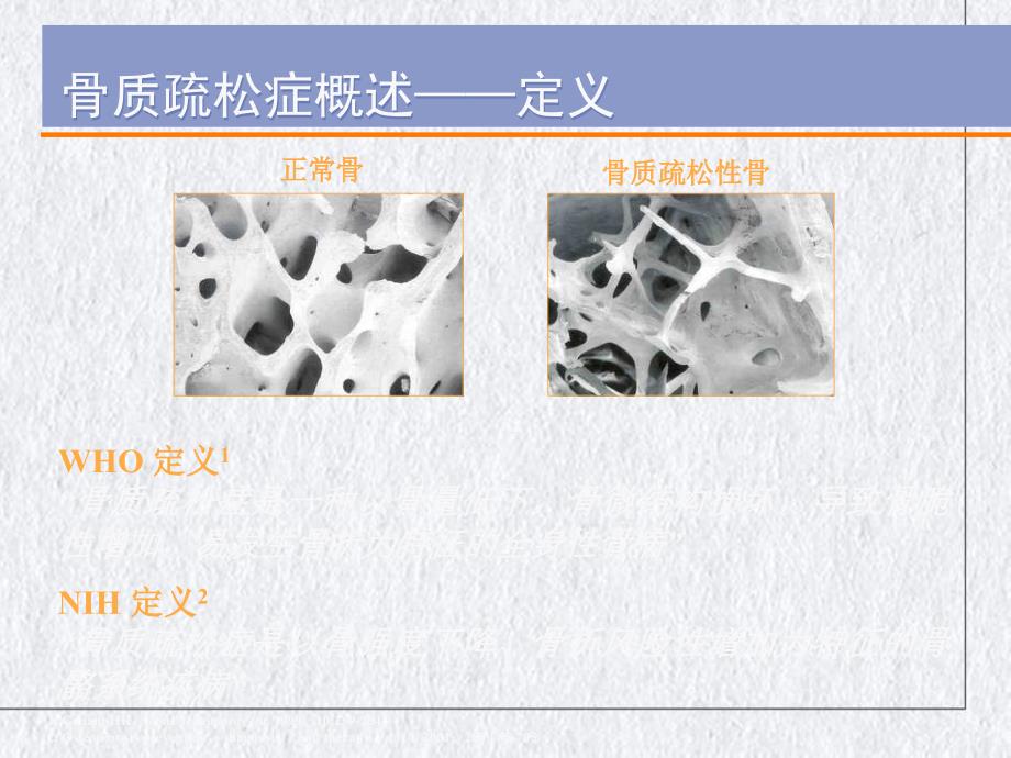 骨质疏松症的诊断与规范治疗讲课ppt课件_第1页