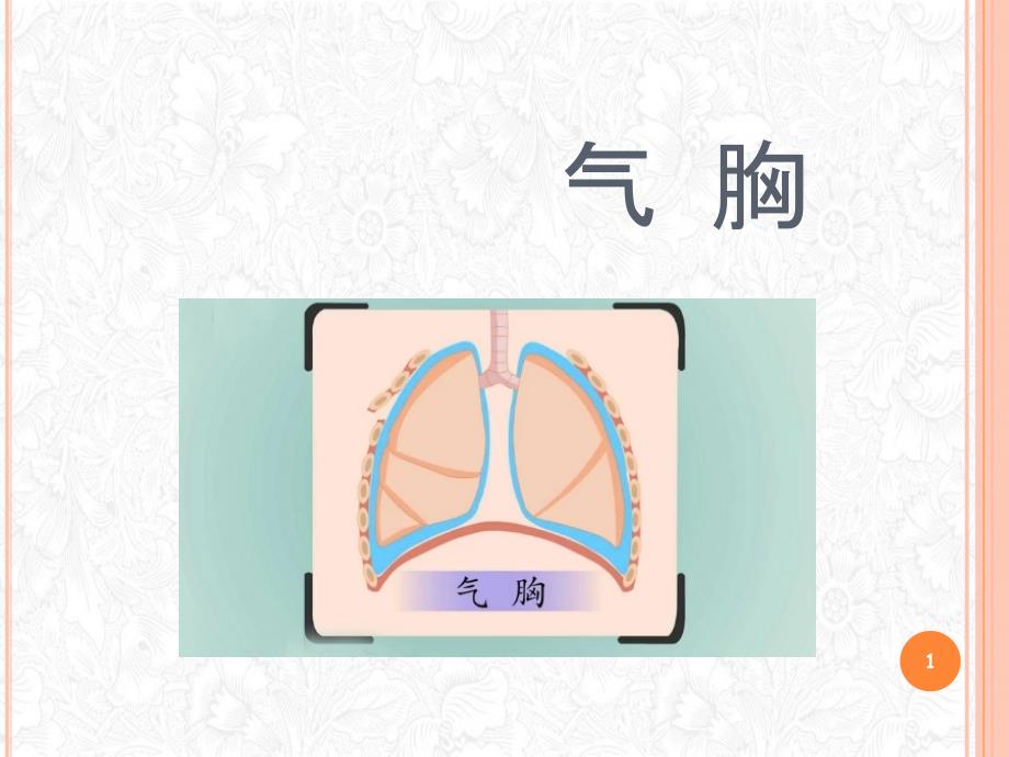 气胸血气胸脓胸护理常规讲课课件_第1页