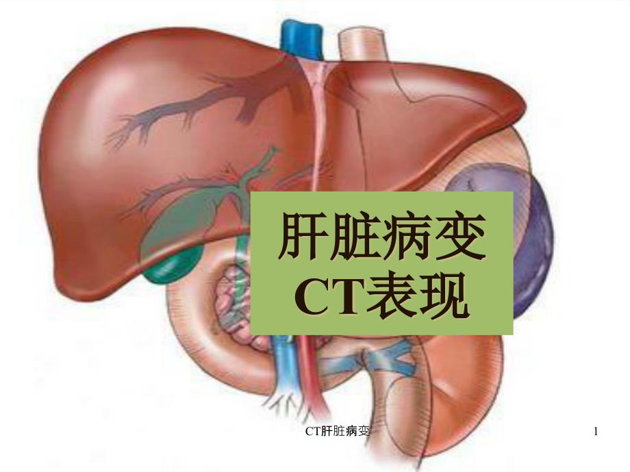 CT肝脏病变ppt课件_第1页