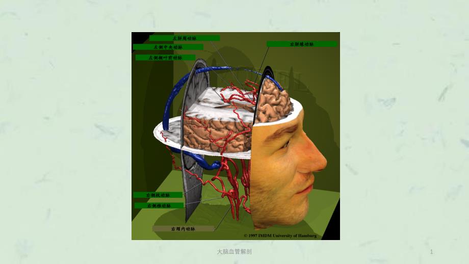 大脑血管解剖ppt课件_第1页