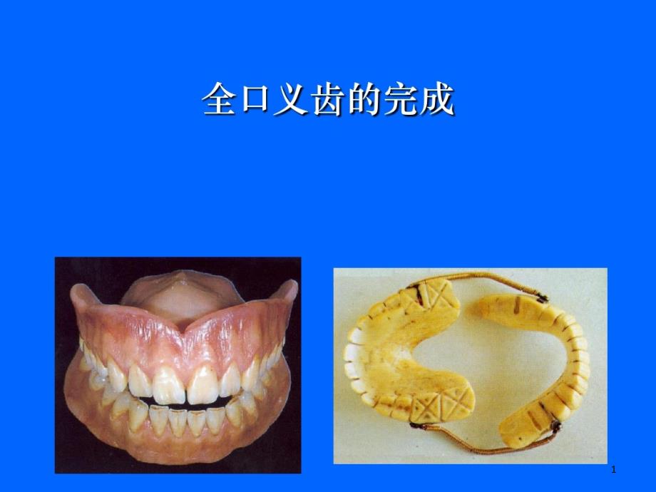 全口义齿制作步骤课件_第1页